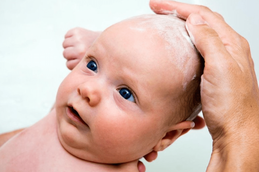 Молочные корочки на голове новорожденного