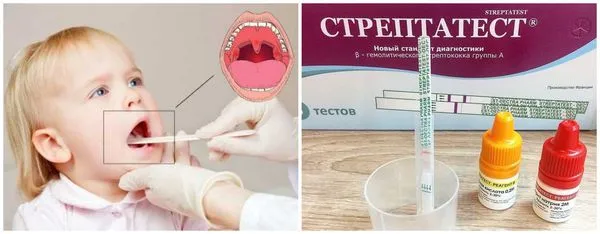 Streptococcal infection and Streptatest